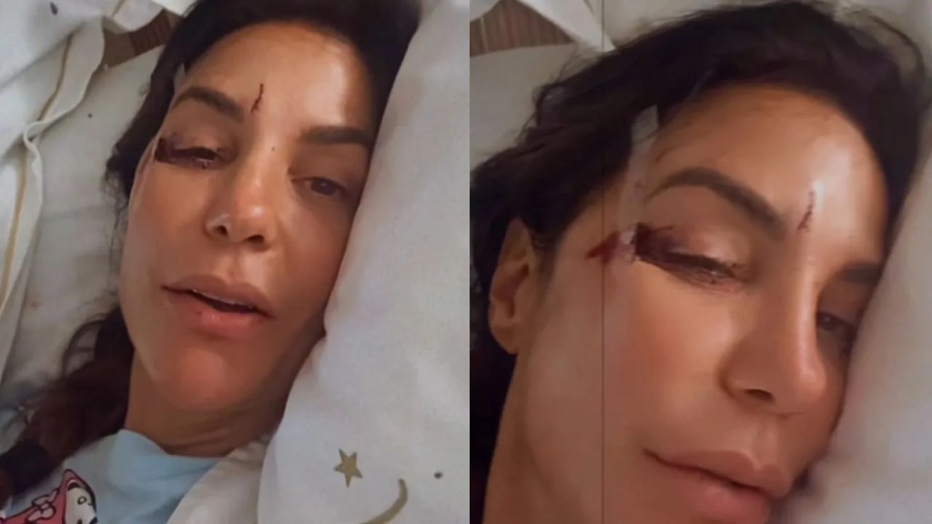 Ivete Sangalo é internada após desmaio: “Que&nbsp;susto”